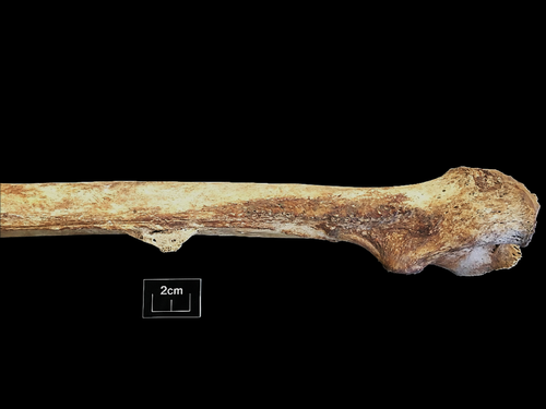 Figure 111
